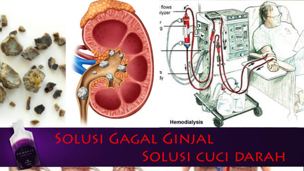 obat reserve untuk gagal ginjal