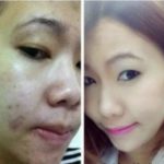 Reserve Jeunesse Minuman Kesehatan Yang Berbentuk Gel